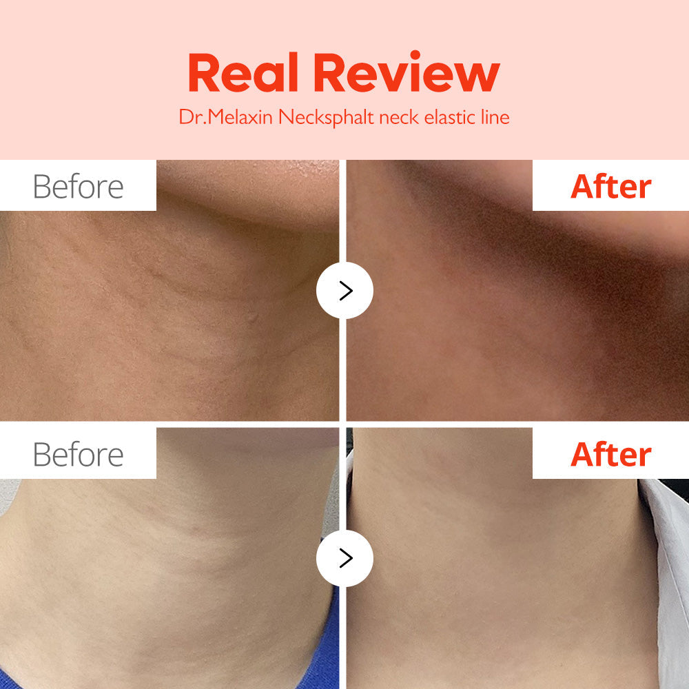 Necksphalt ECM Neck Tightening Line - Dr.Melaxin.us
