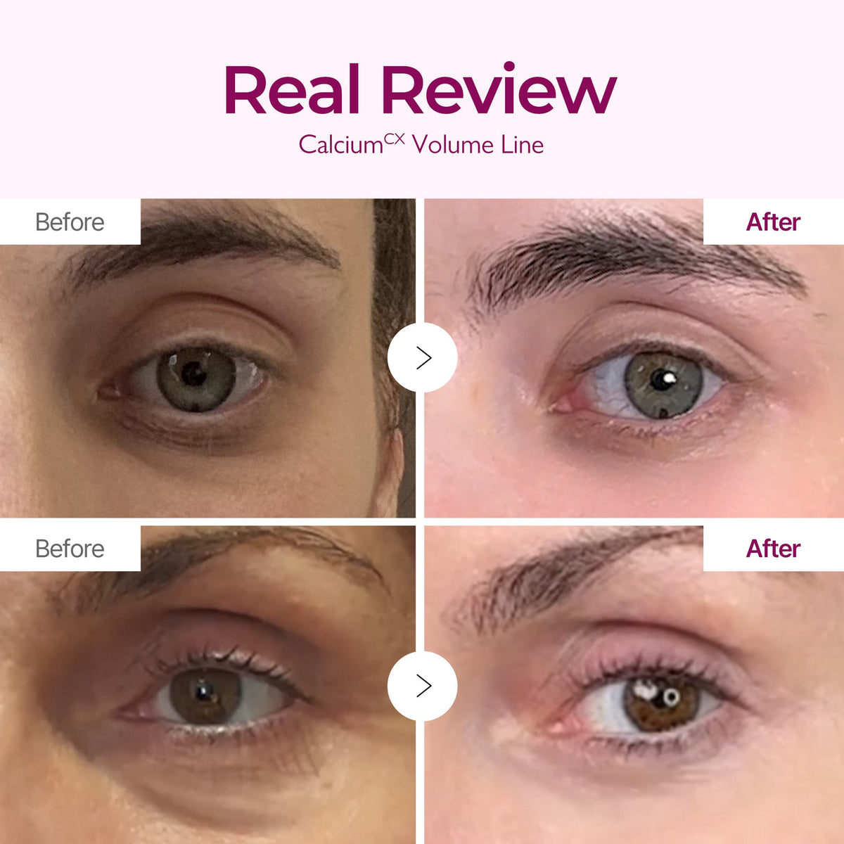 Calcium Intense Cream 3