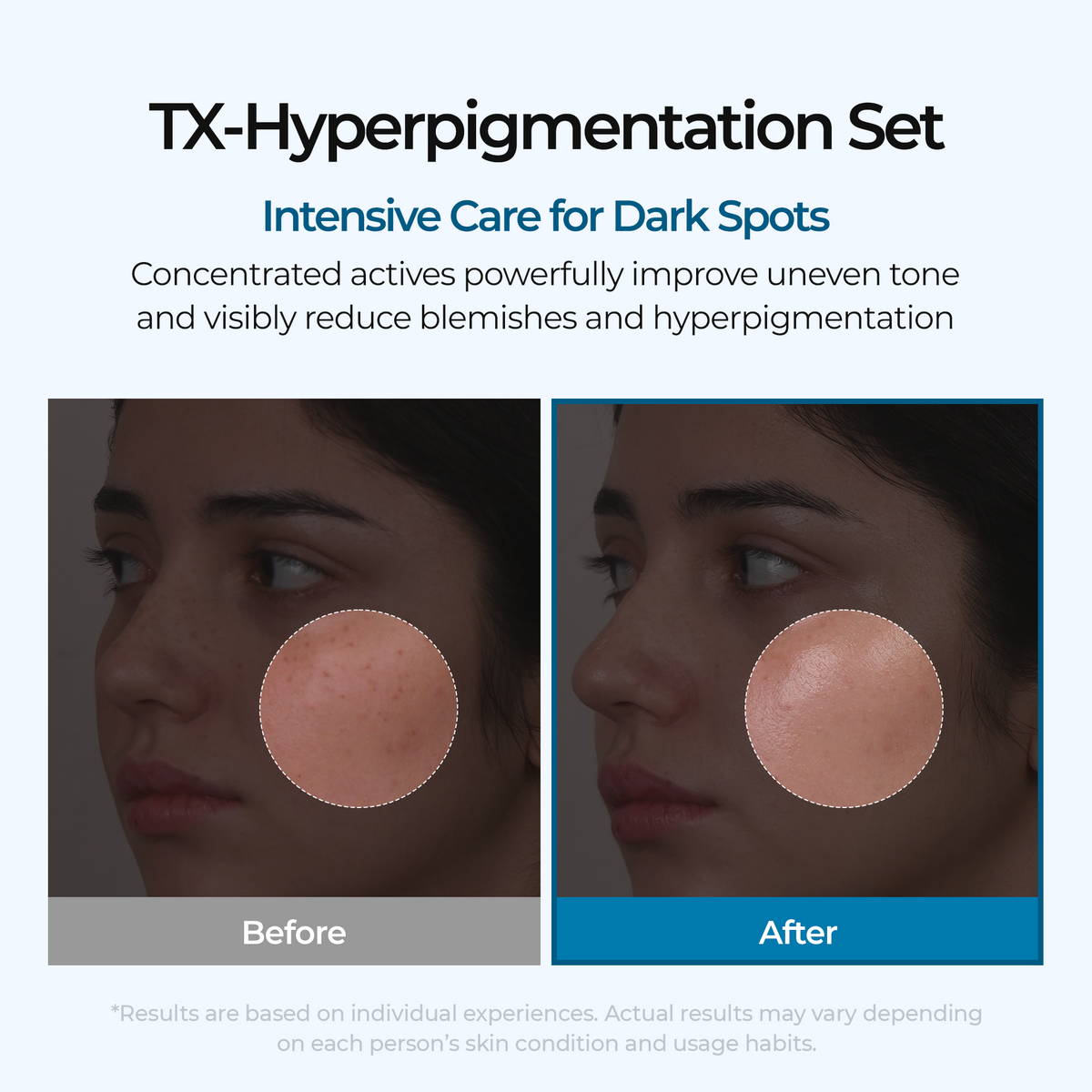 Dark Spot & Uneven Tone Peel Shot TX Duo - Dr.Melaxin.us