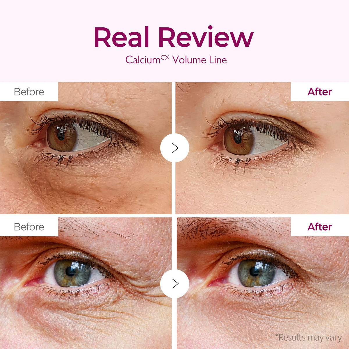 Calcium Volume Eye patch 60ea - Dr.Melaxin.us