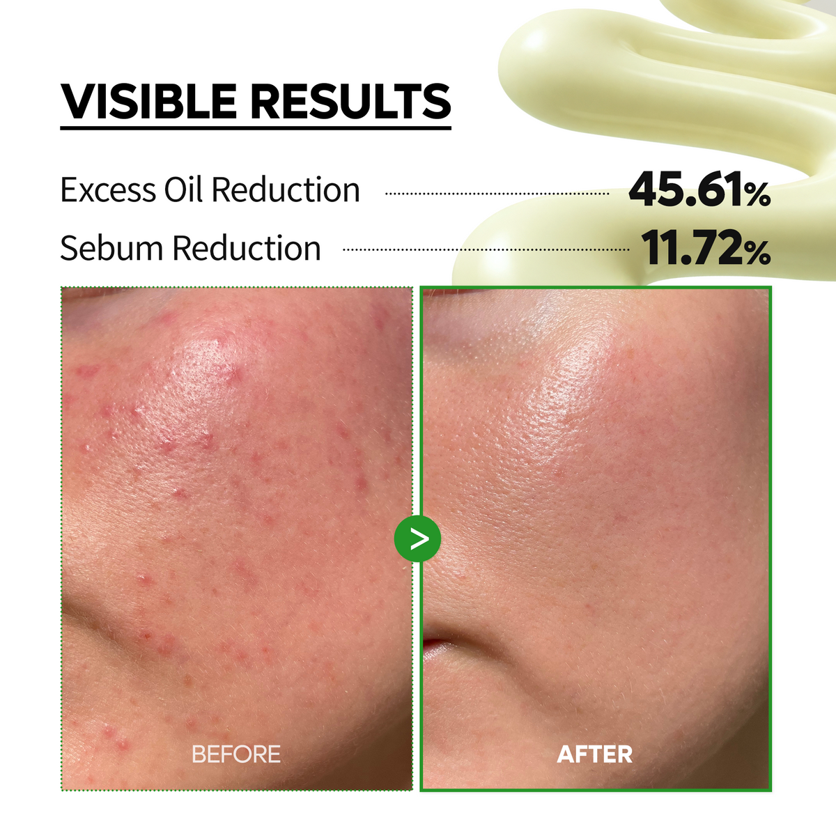 S-ZINC Blemish Cream - Dr.Melaxin.us