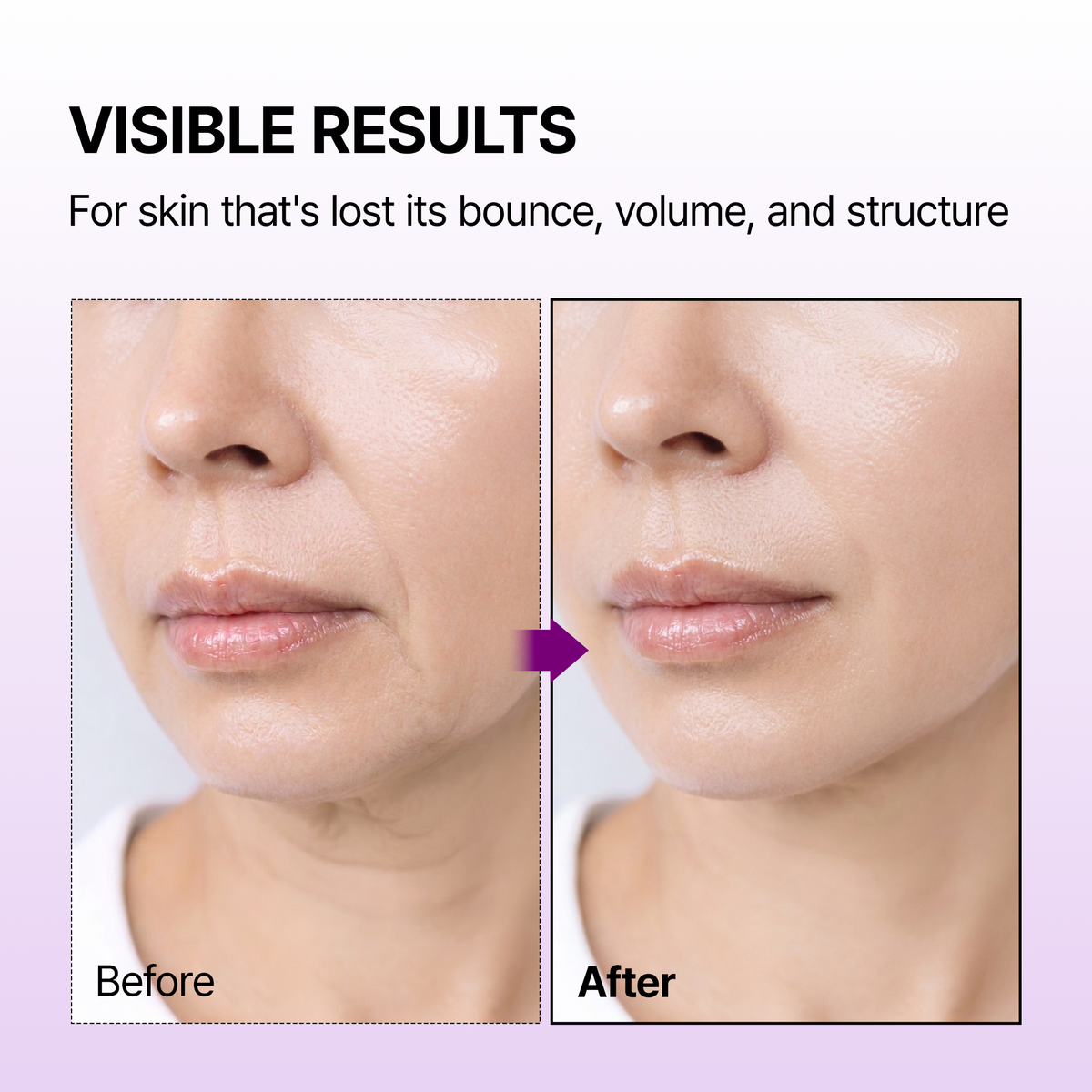 Calcium Bonding Facial Cream - Dr.Melaxin.us