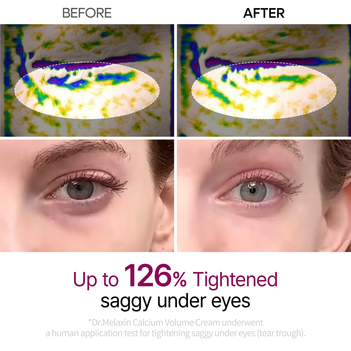 Calcium Eye care Line - Dr.Melaxin.us