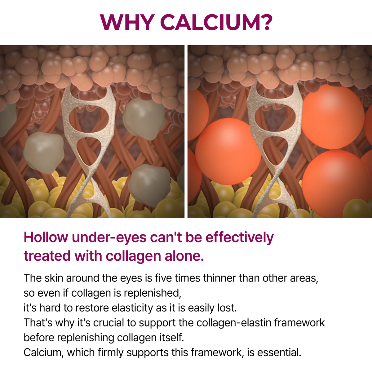 Calcium Eye care Line - Dr.Melaxin.us