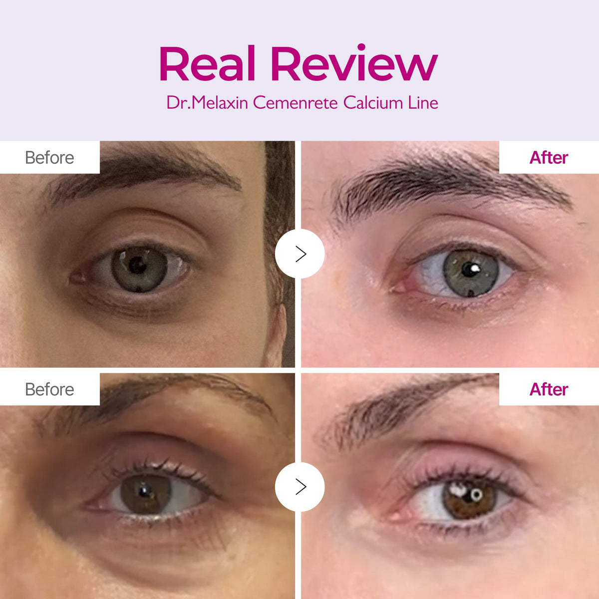 Cemenrete Calcium SET - Dr.Melaxin.us