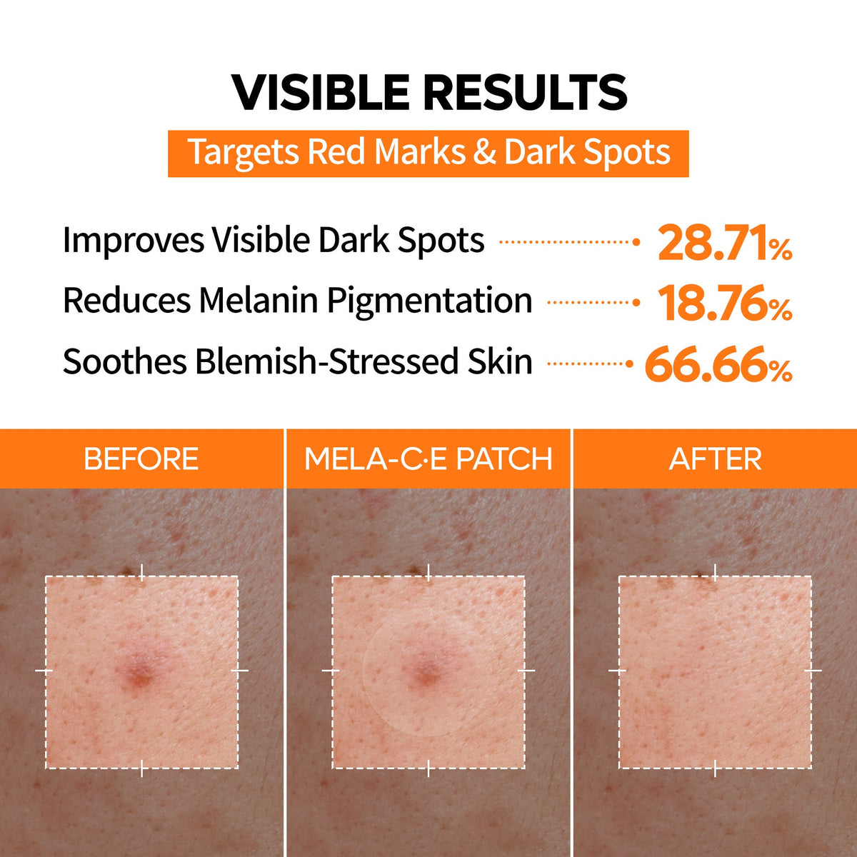 MELA-C·E ZERO FIT Ultra Thin Dark Spot Patch - Dr.Melaxin.us