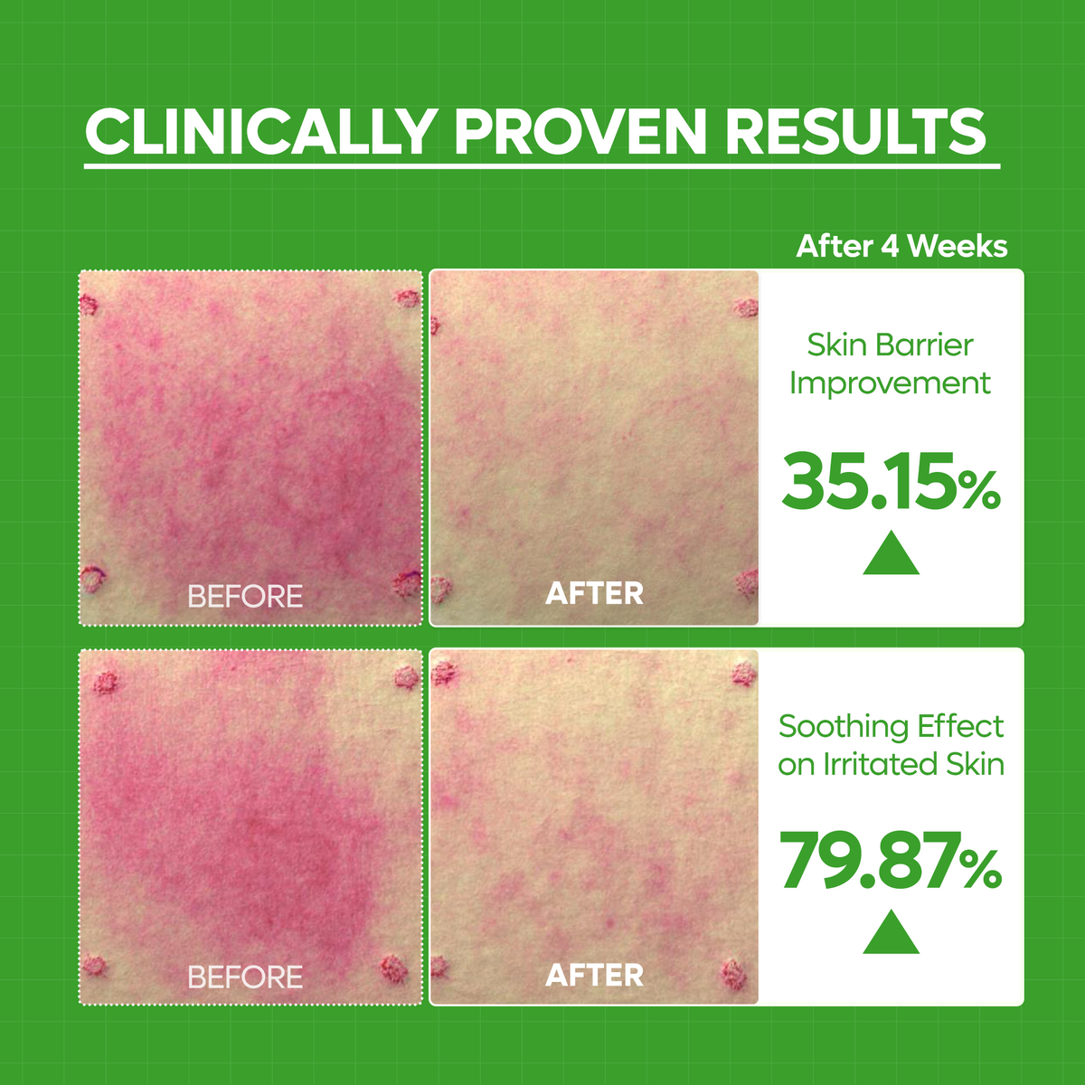 S-ZINC Blemish Cream - Dr.Melaxin.us
