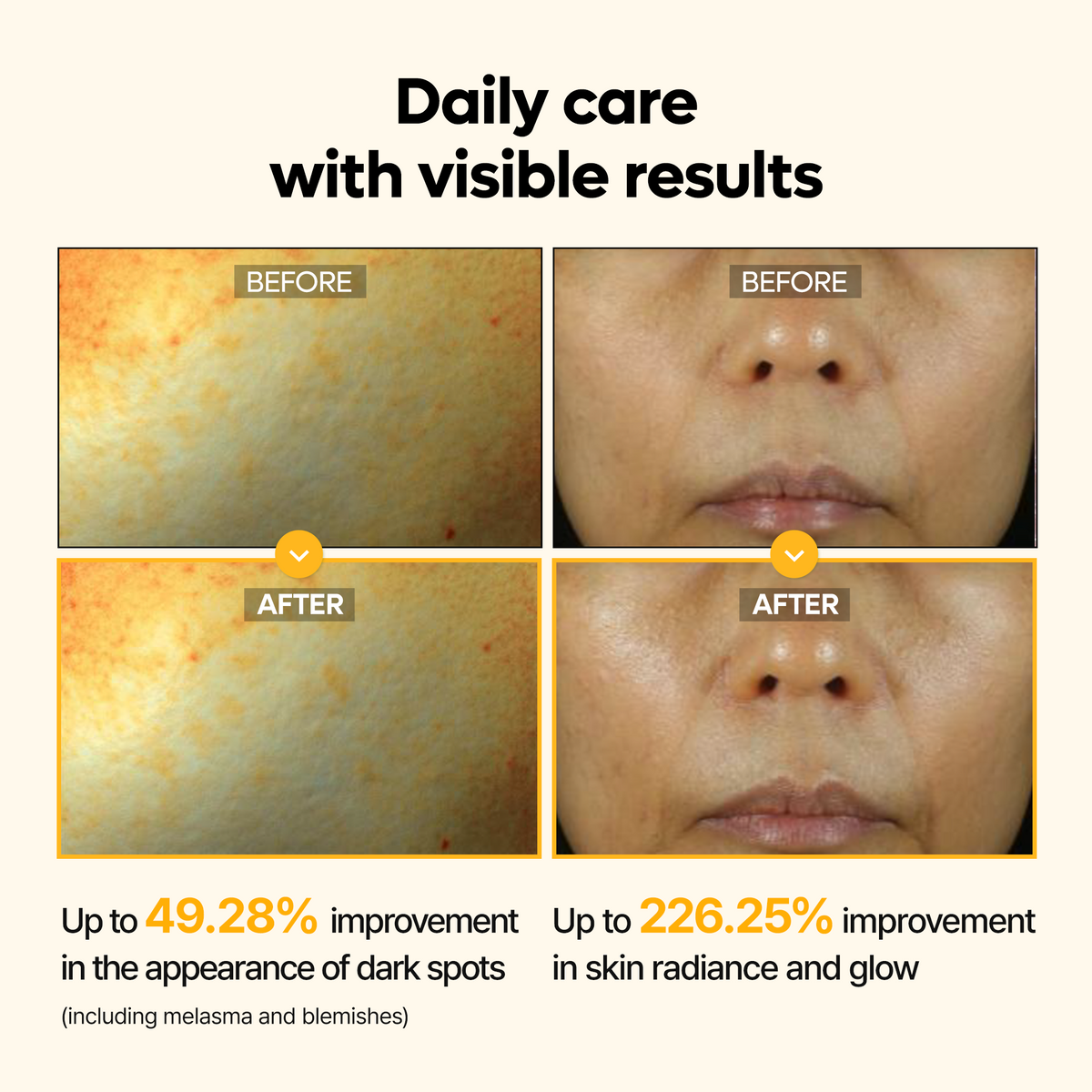 Kojic Acid Turmeric Serum - Dr.Melaxin.us
