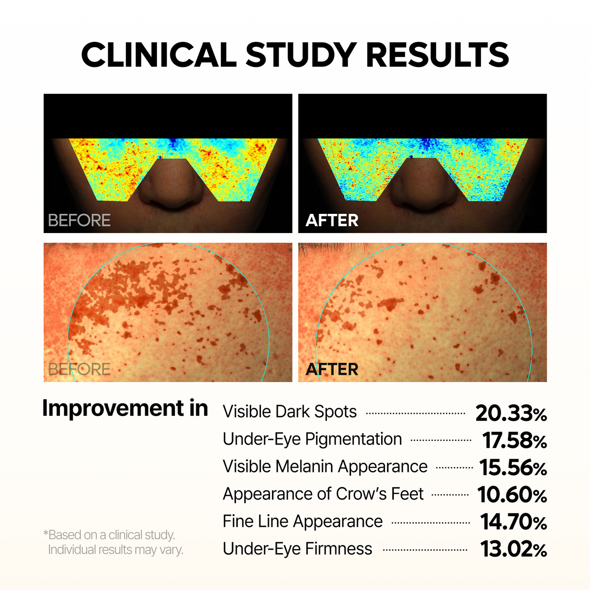 MELA-C·E Ferulic Eye Cream - Dr.Melaxin.us