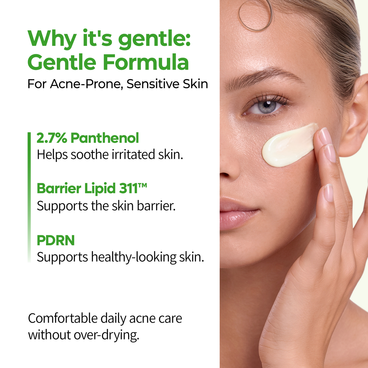 S-ZINC Blemish Cream - Dr.Melaxin.us