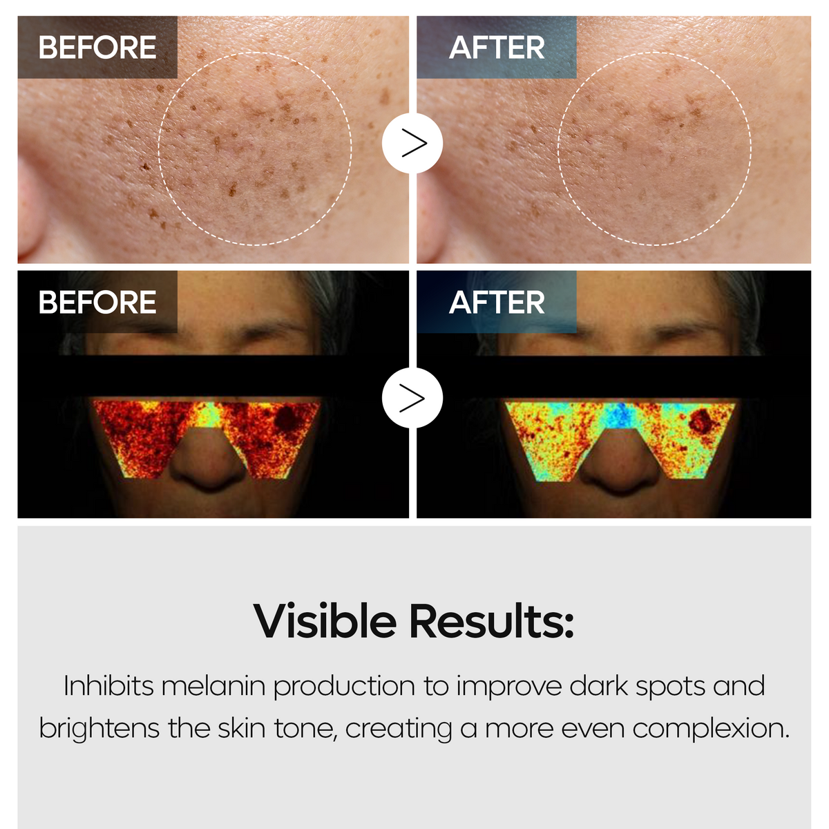TX Tranexamic Acid Dark Spot Care Line - Dr.Melaxin.us