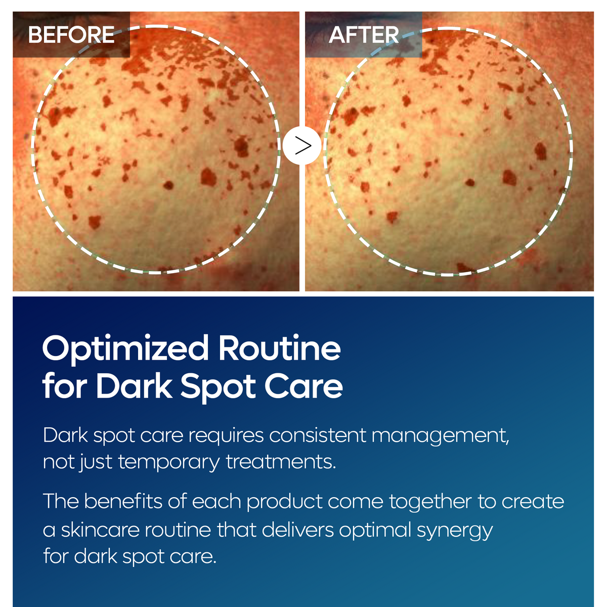 TX Tranexamic Acid Dark Spot Care Line - Dr.Melaxin.us