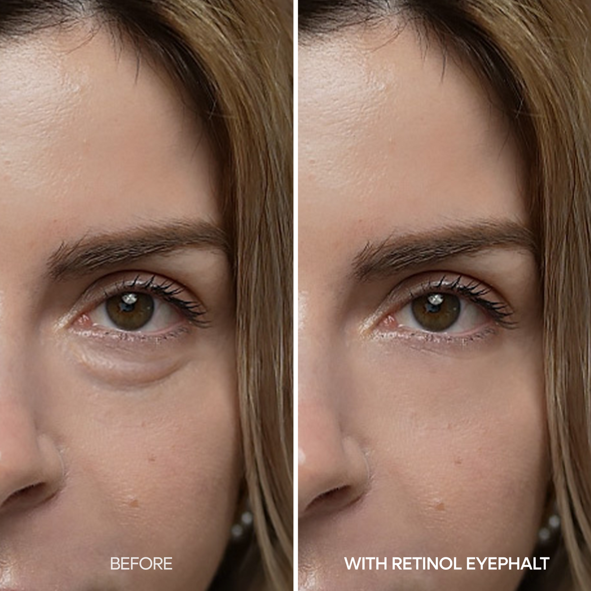 Retinol Eyebag Cream - Dr.Melaxin.us