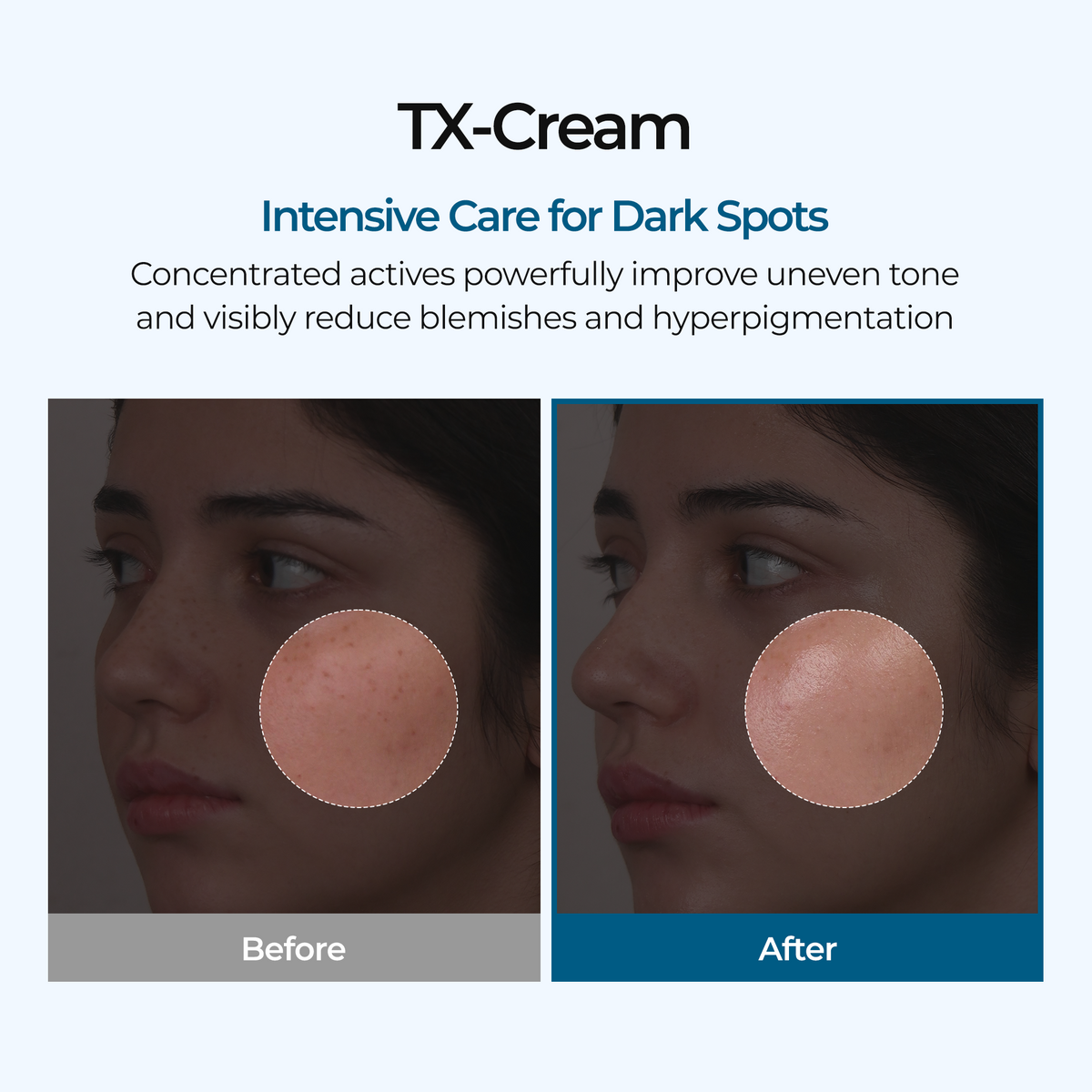 TX Cream - Dr.Melaxin.us