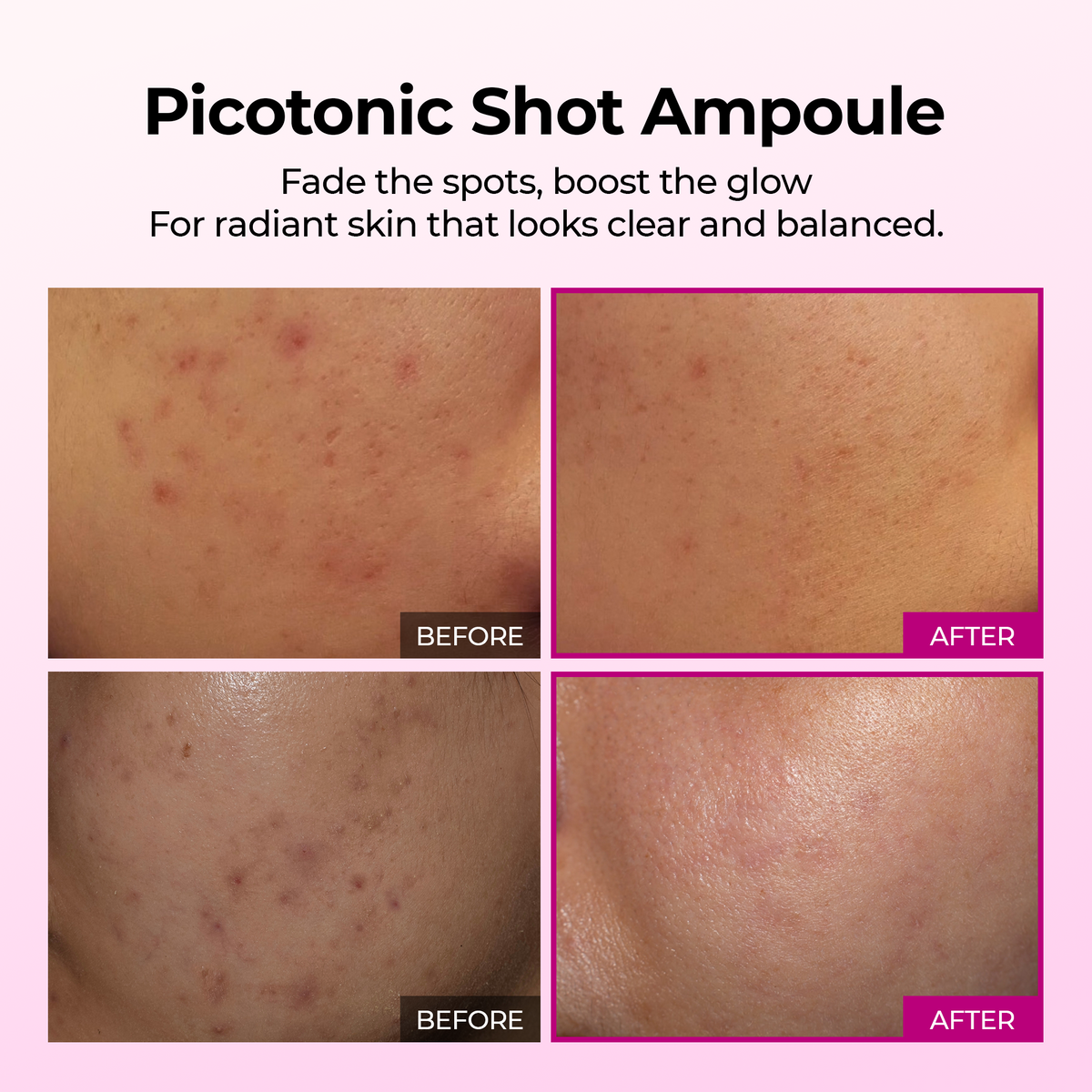 Picotonic Shot Pigmentation Ampoule - Dr.Melaxin.us
