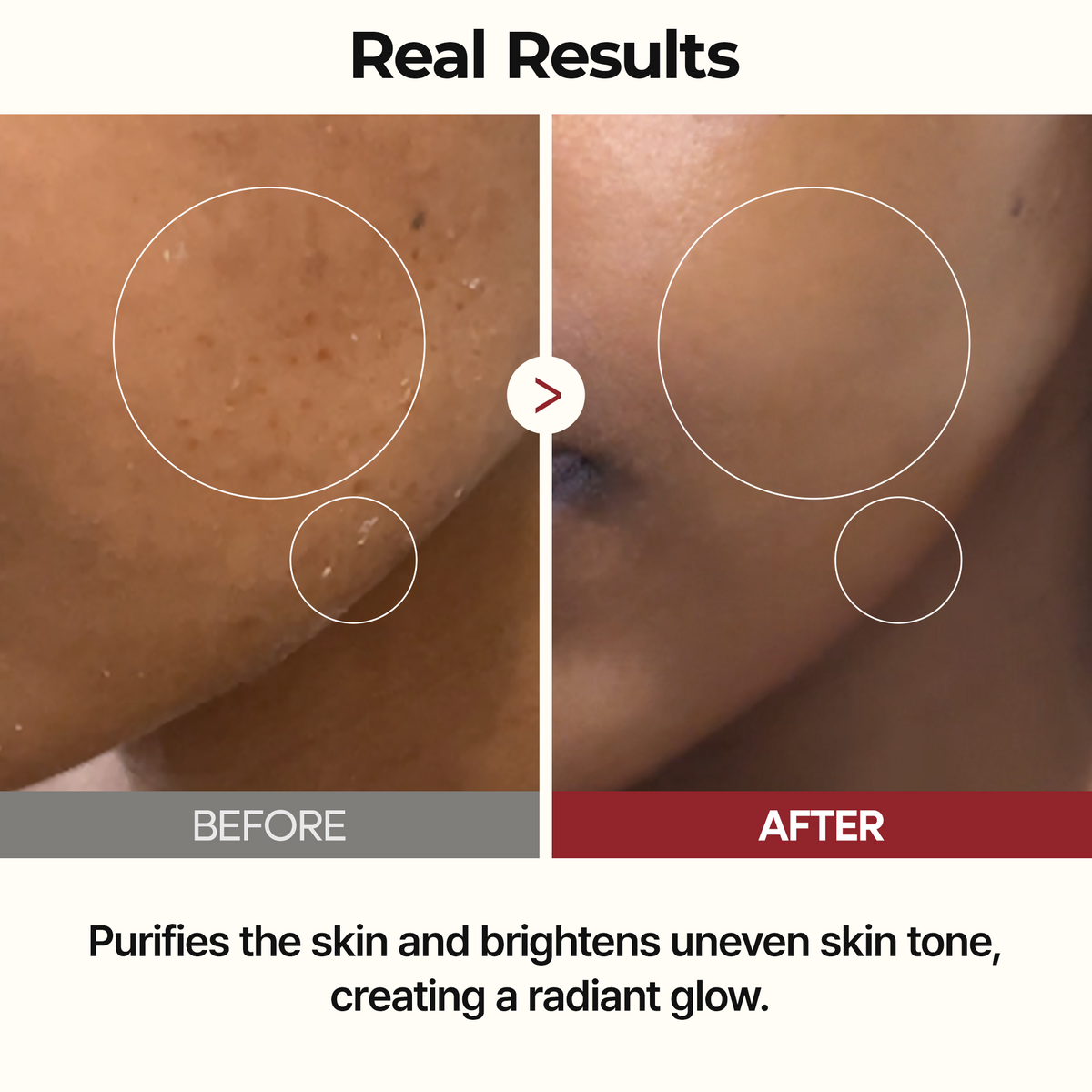 Peel Shot Glow Rice Toner - Dr.Melaxin.us