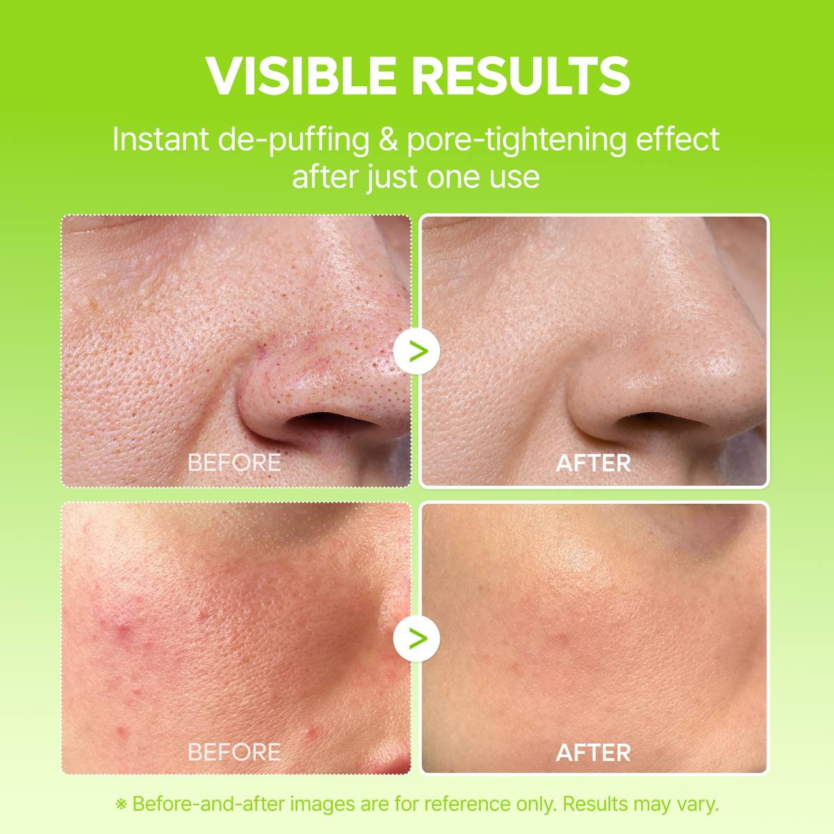 Cactox Pore Relief Jelly Serum Mist - Dr.Melaxin.us