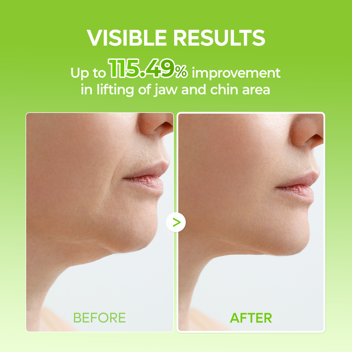 Cactox V-Lifting Mewing Band 4EA - Dr.Melaxin.us