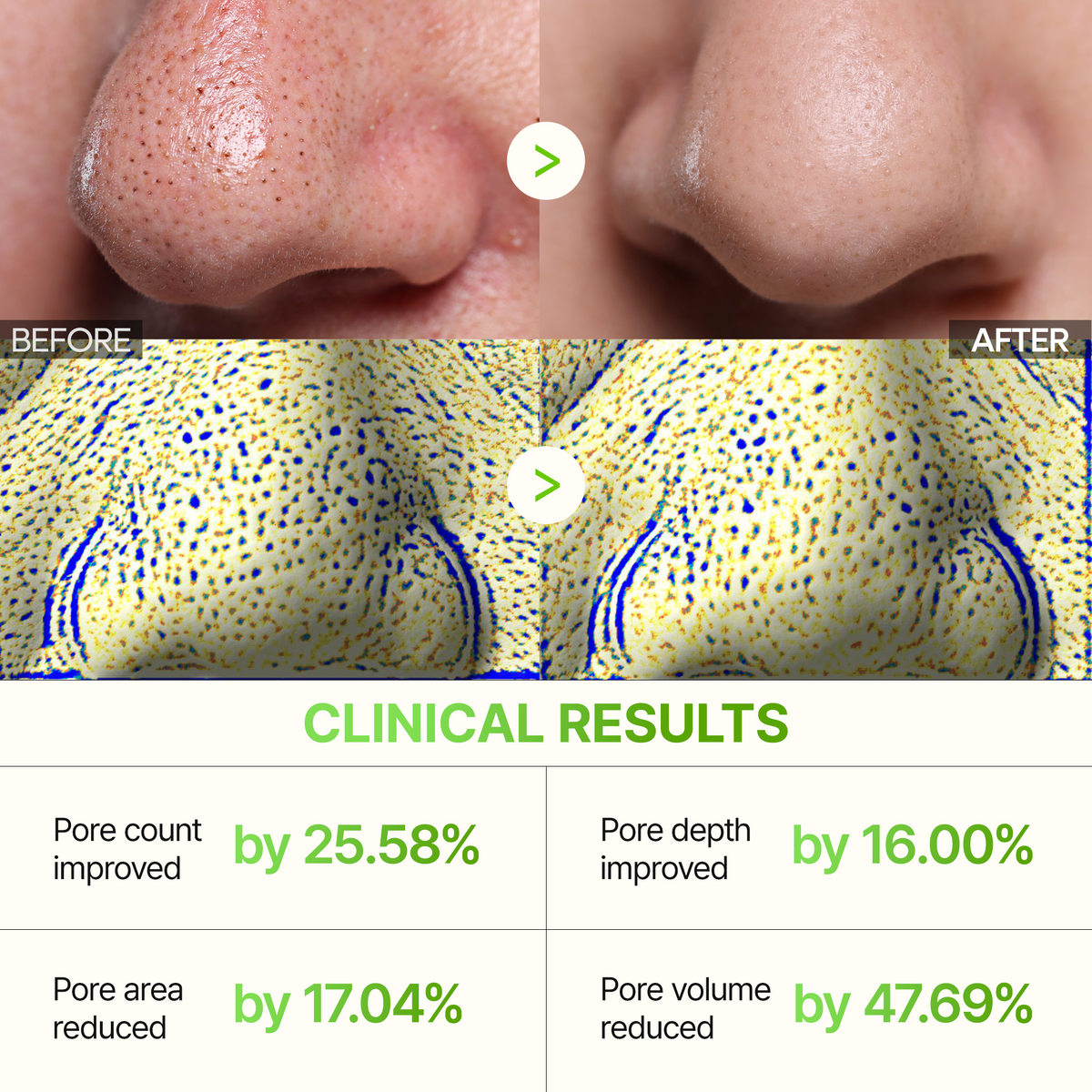 Cactox 3-Step Nose Mask Pack - Dr.Melaxin.us