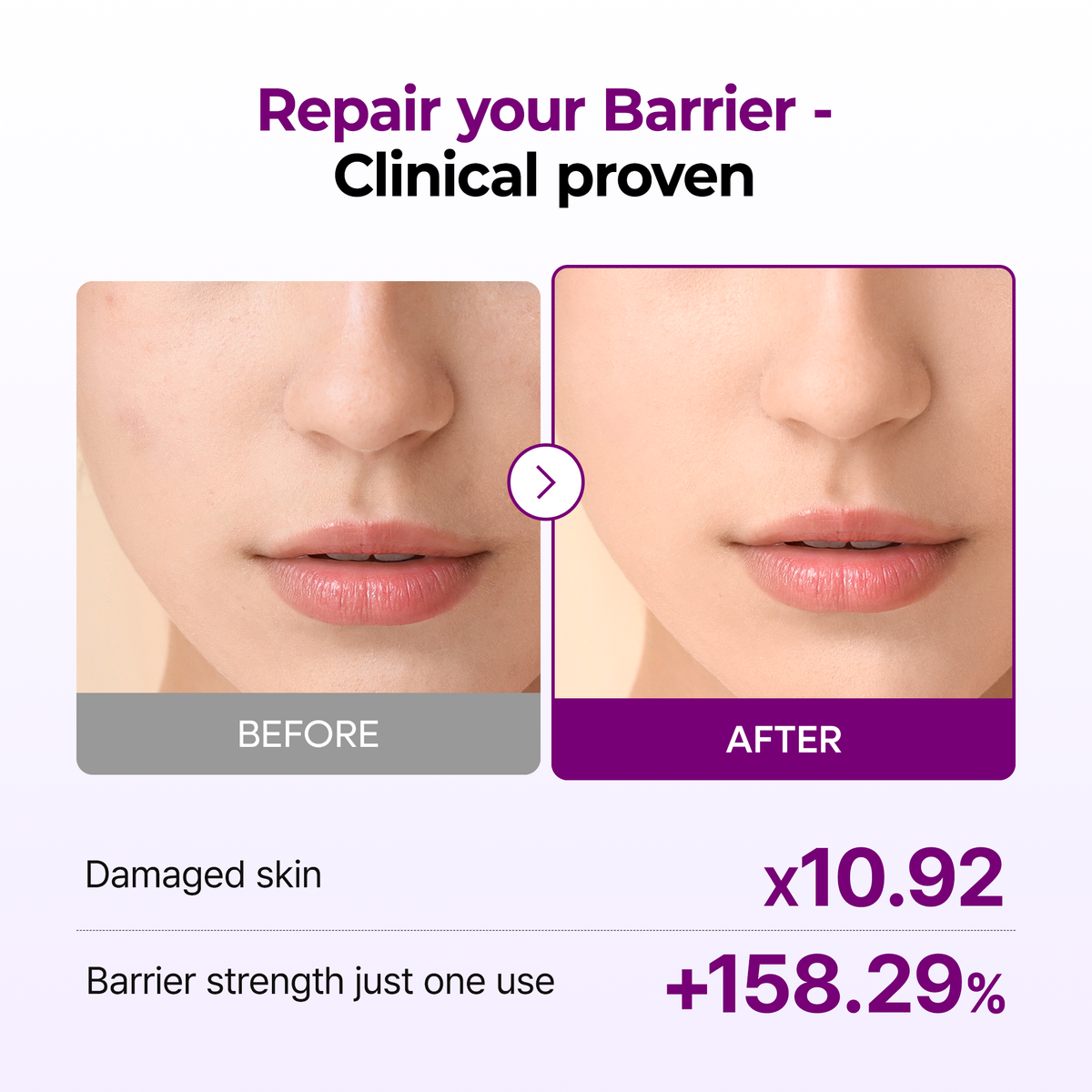 Calcium Bonding Barrier Repair Toner - Dr.Melaxin.us