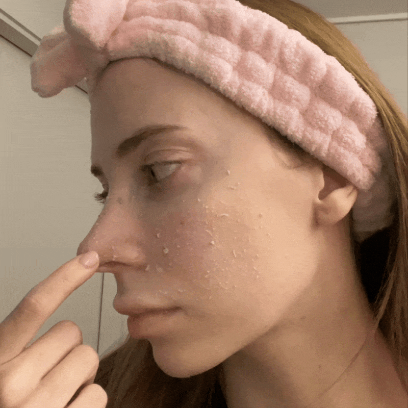 [⚡50K+ Sold] Peel Shot Glow Rice Ampoule — AHA BHA Gentle Exfoliator - Dr.Melaxin.us