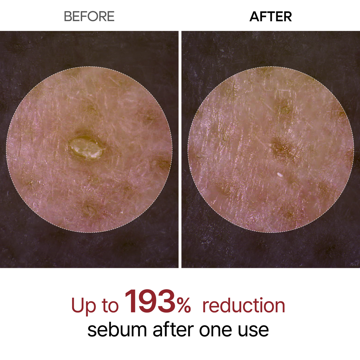 [⚡50K+ Sold] Peel Shot Glow Rice Ampoule — AHA BHA Gentle Exfoliator - Dr.Melaxin.us