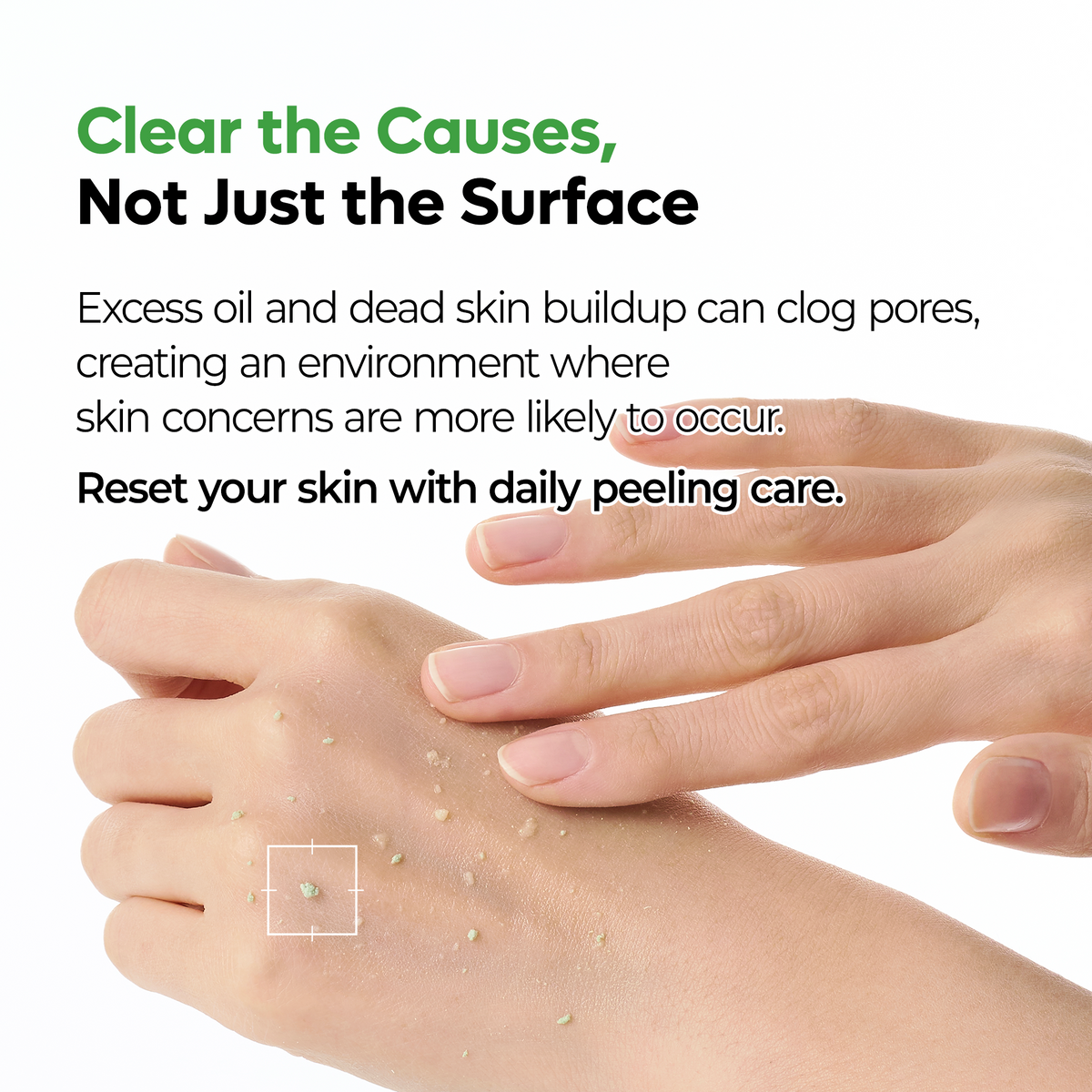 PEEL SHOT Exfoliating S-ZINC Blemish Serum - Dr.Melaxin.us
