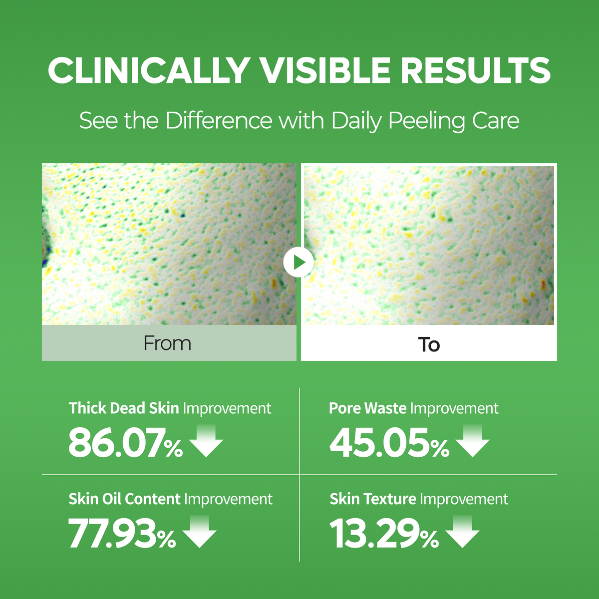 PEEL SHOT Exfoliating S-ZINC Blemish Serum - Dr.Melaxin.us