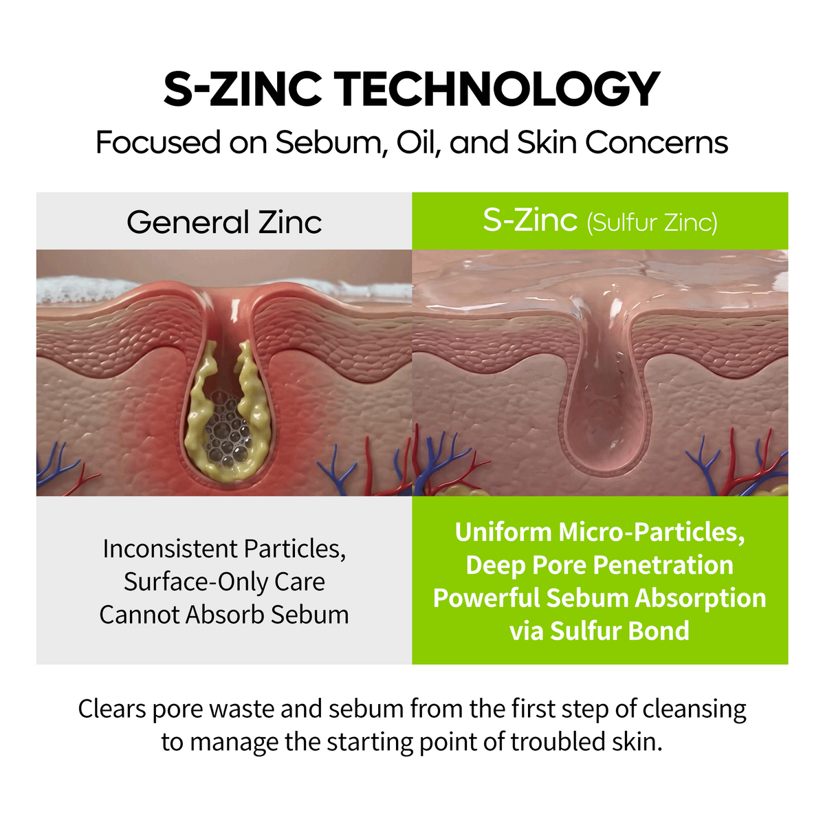 S-ZINC Blemish Gel Cleanser - Dr.Melaxin.us