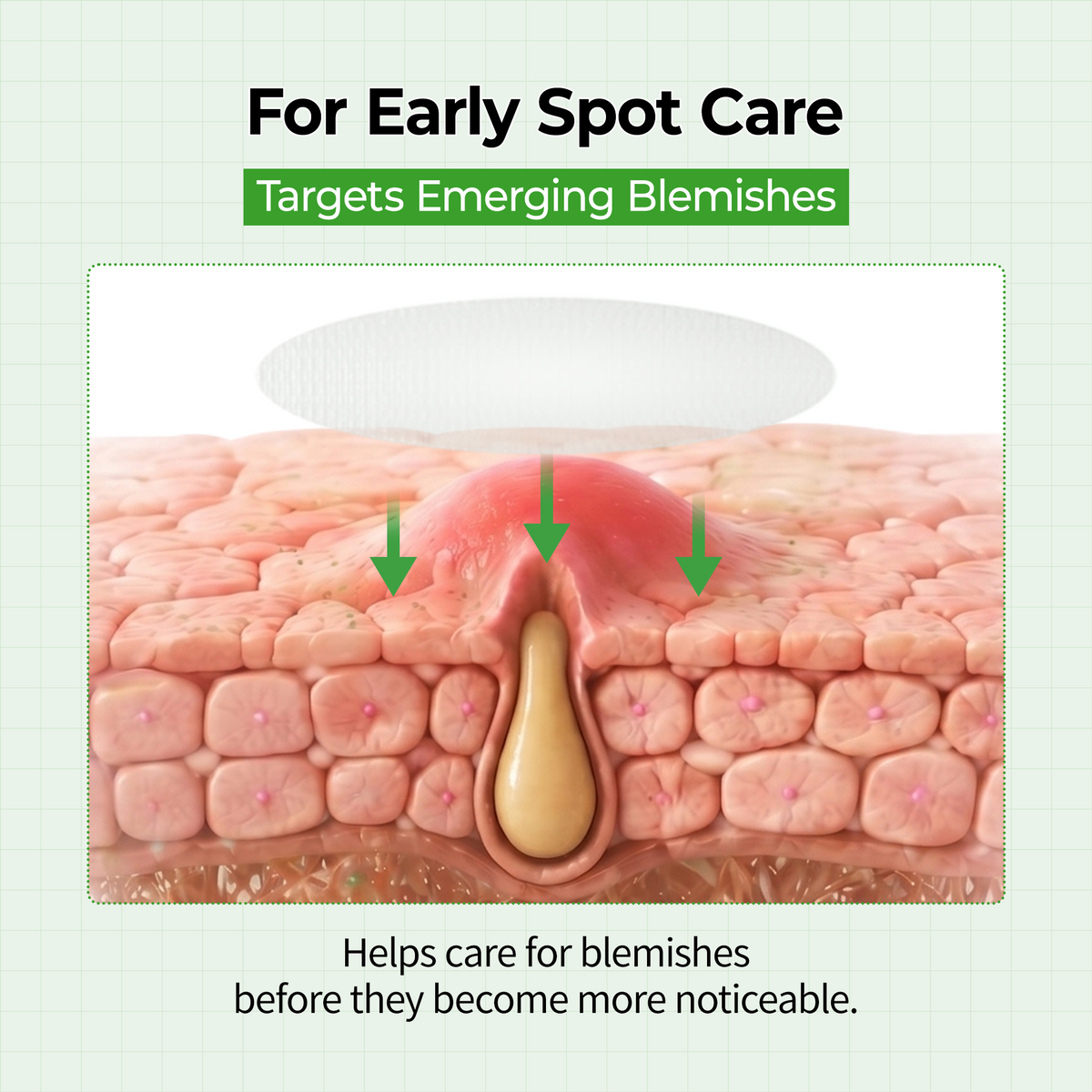 S-ZINC ZERO FIT Ultra Thin Blemish Spot Patch - Dr.Melaxin.us