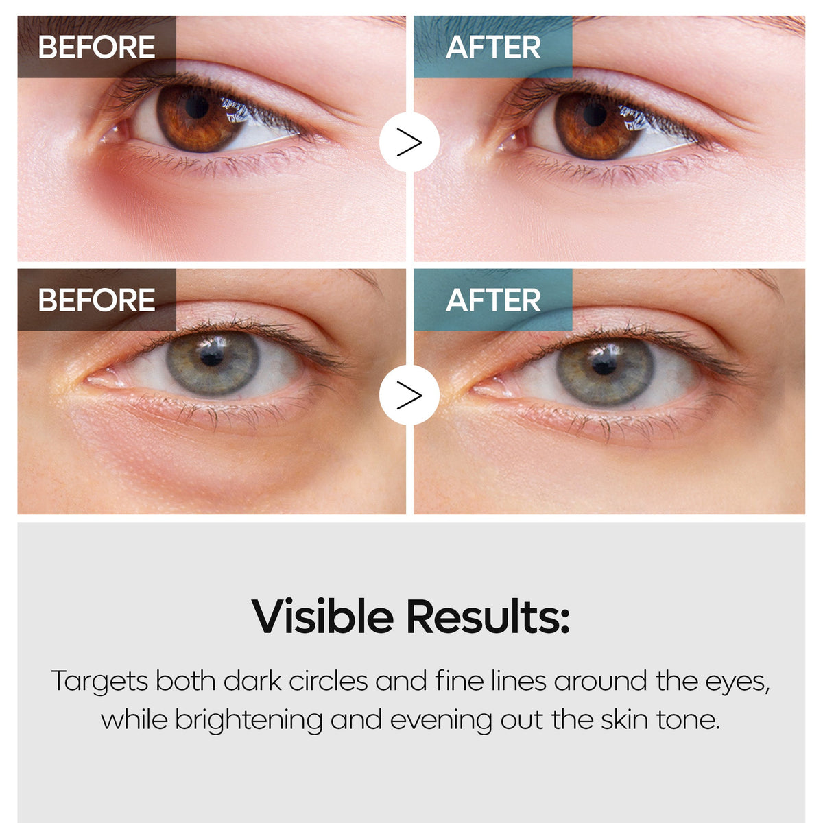 TX Retinalsome Double Effect Eyecream - Dr.Melaxin.us