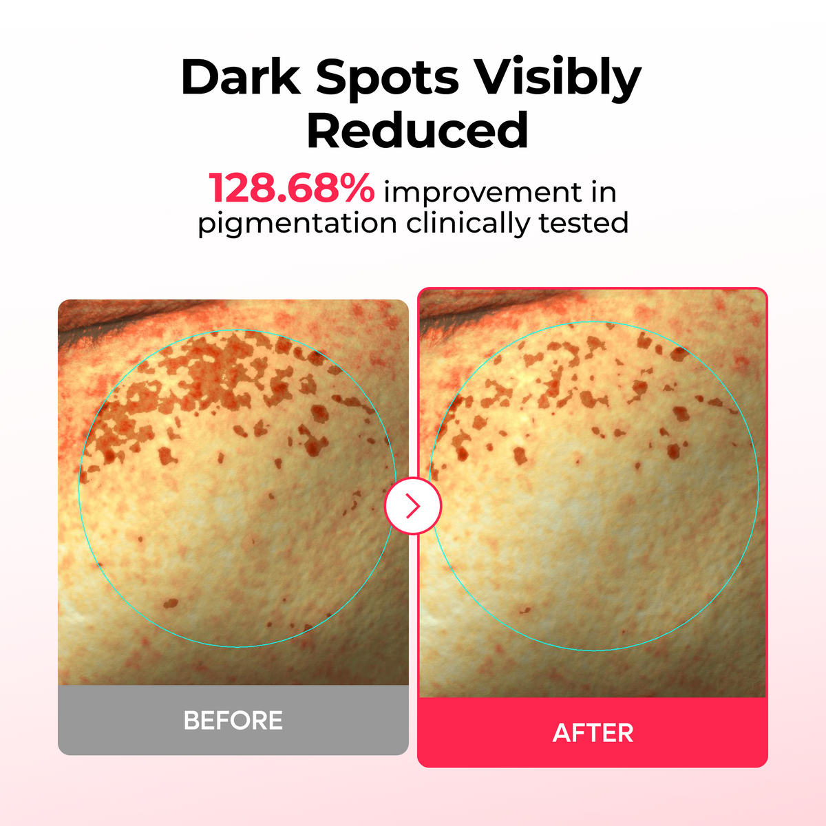 TX Astaxanthin Dark Spot Care Hydrogel Mask 4EA - Dr.Melaxin.us