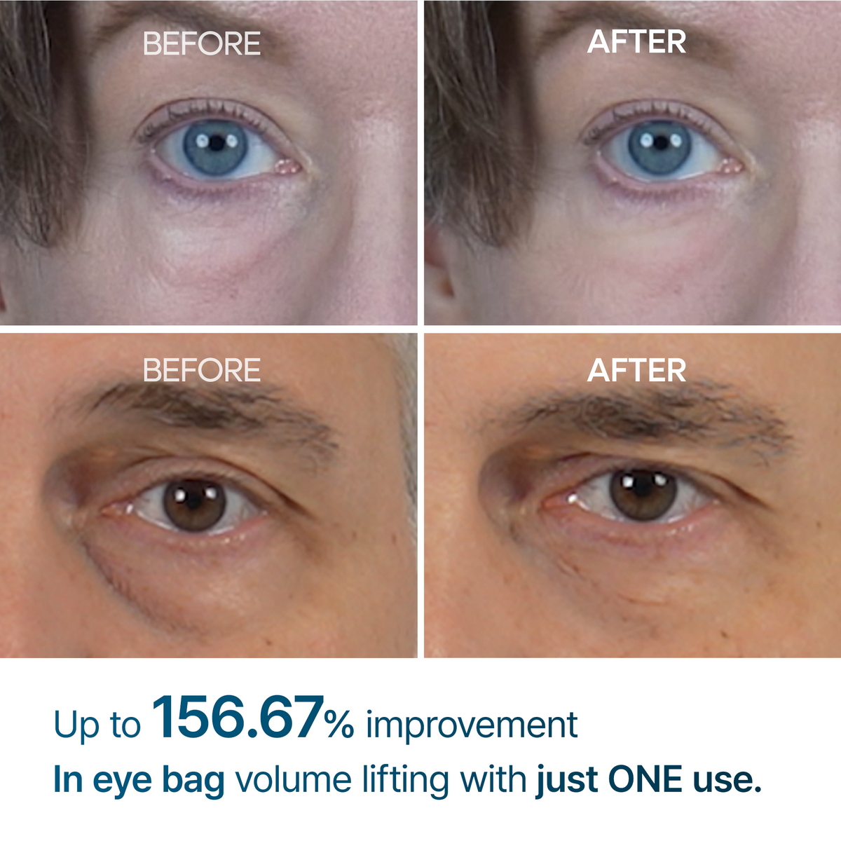 Eyephalt eyebag cream - Dr.Melaxin.us
