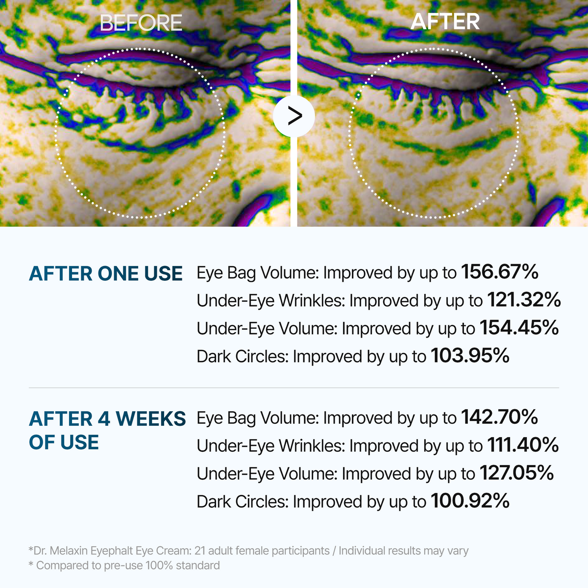 Eyephalt eyebag cream - Dr.Melaxin.us