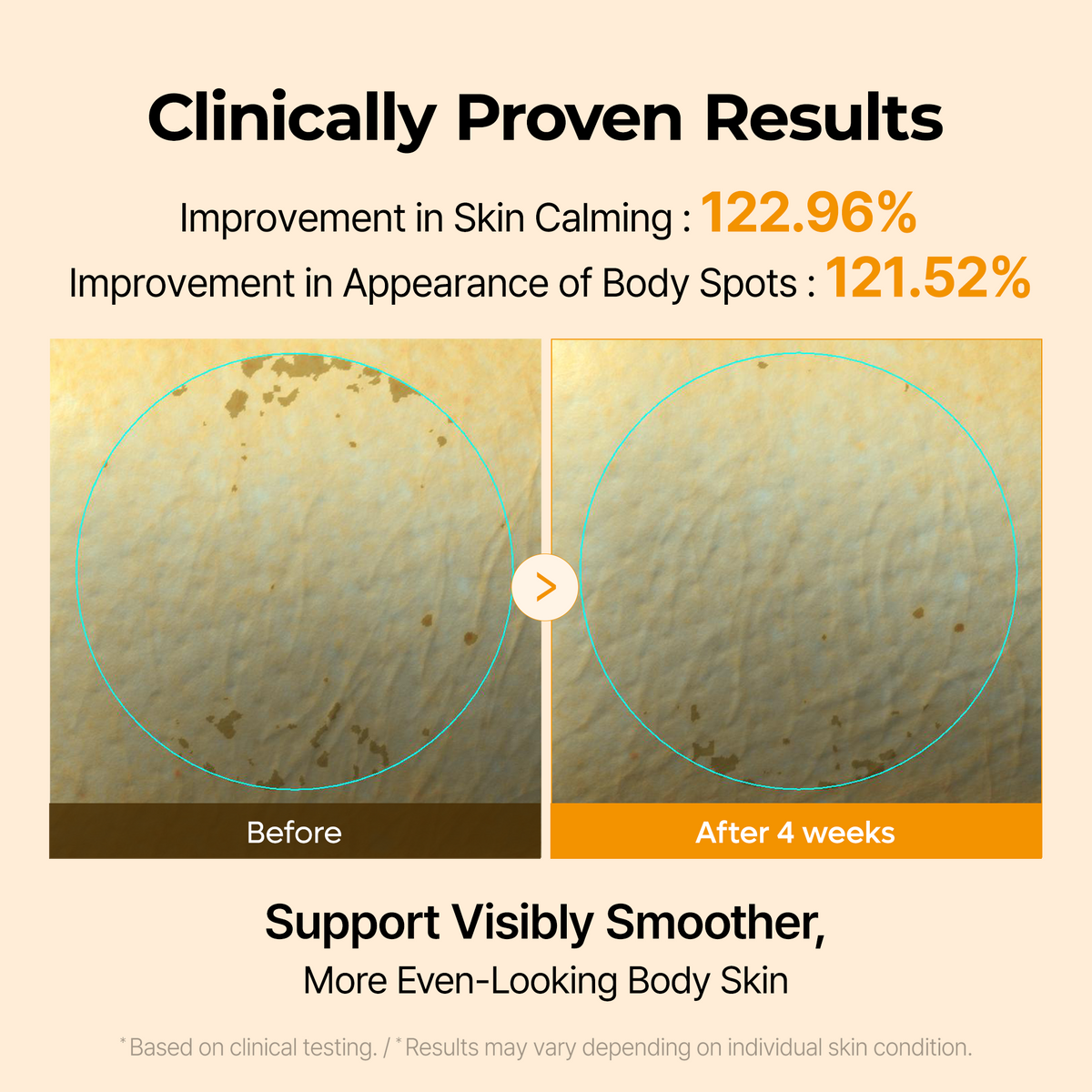 Kojic Acid Turmeric Capsule Body Cream - Dr.Melaxin.us