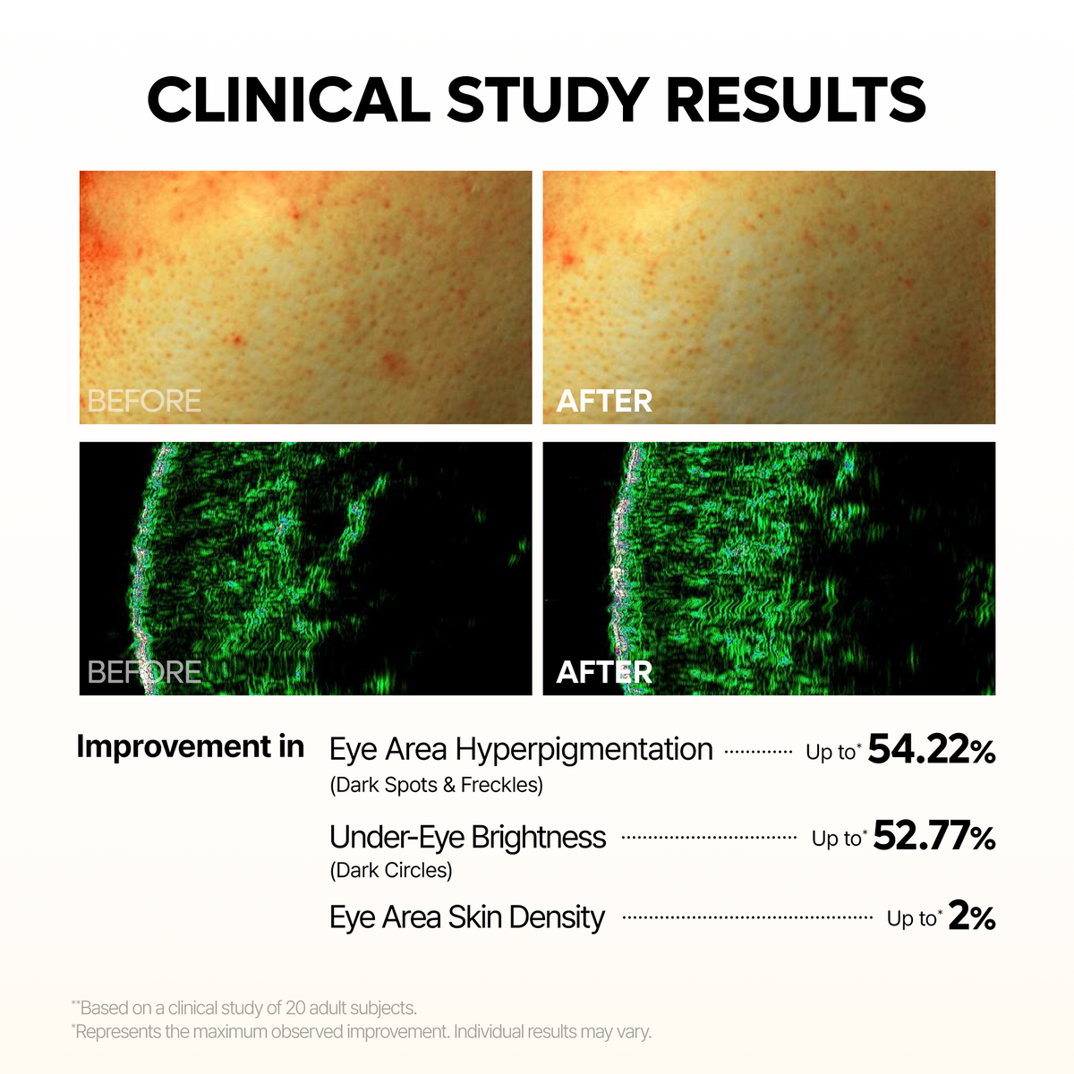 TX-Kojic Acid Retinal Eye patch - Dr.Melaxin.us