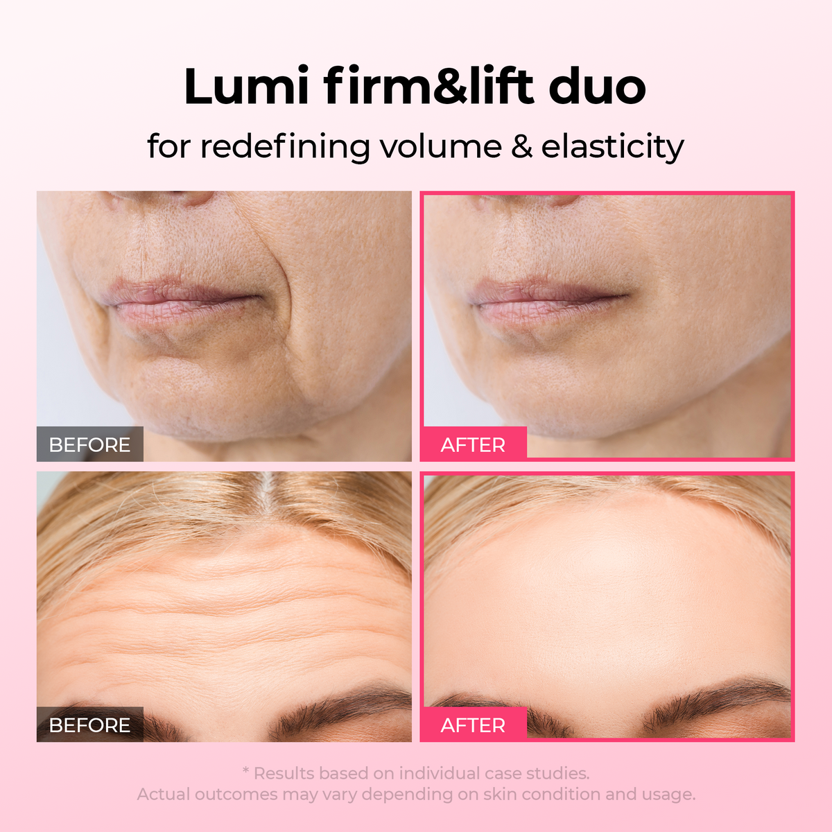 [TikTok Bestseller] Lumi firm & lift Duo - Dr.Melaxin.us