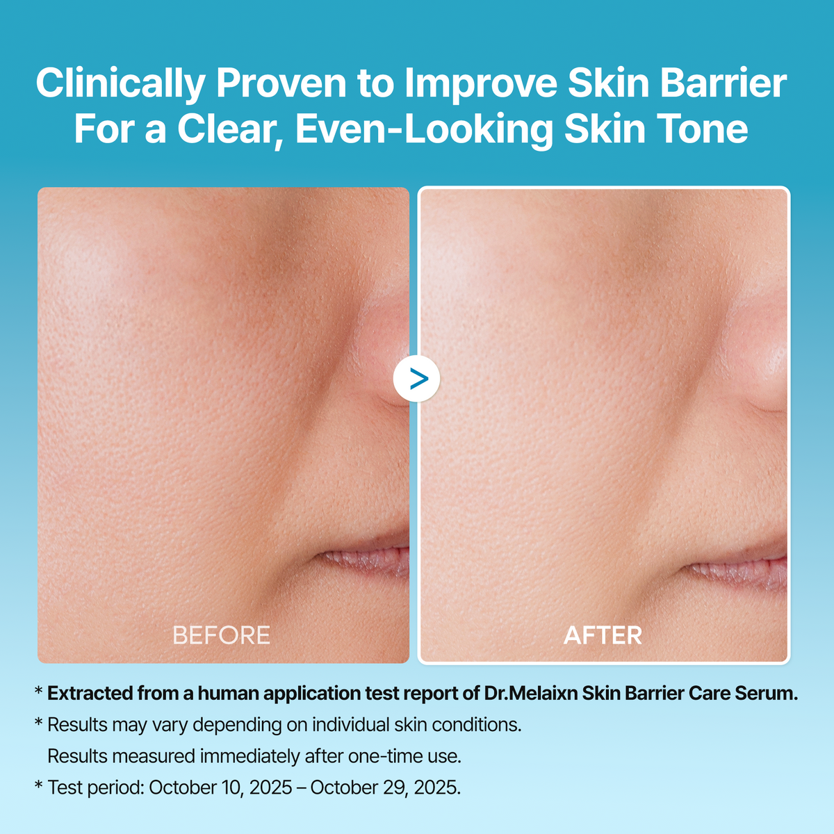Peel Shot Exfoliating TX Serum - Dr.Melaxin.us